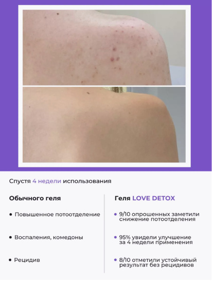 Prosto ­Черный гель для душа LOVE DETOX модель 4870231230042 — фото 5 - INTERTOP