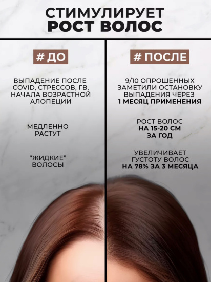 Prosto ­СЫВОРОТКА ДЛЯ ВОЛОС #PROSTO GROW IT ПРОТИВ ВЫПАДЕНИЯ И РЕАКТИВАЦИИ РОСТА модель 4870231230417 — фото 3 - INTERTOP